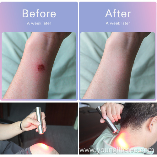 LED light infrared target pain relief therapy torch